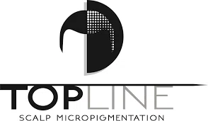 Topline SMP